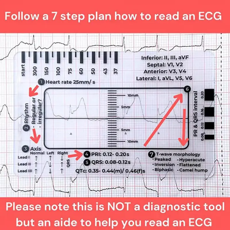 Thước 7 Bước, Cầm Tay, Hướng Dẫn Tham Khảo Bỏ Túi Giải Thích Ecg, Trong Suốt, Thiết Kế Nhỏ Gọn, Dụng Cụ Đánh Giá, Để Đo Lường 1
