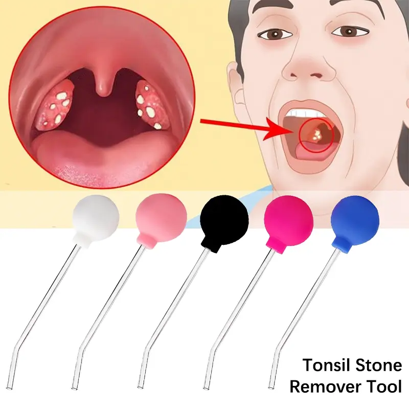 Alat Penyingkiran Batu Tonsil, Gaya Manual, Alat Penjagaan Pembersihan Mulut, Lilin Telinga, Alat Pembersihan
