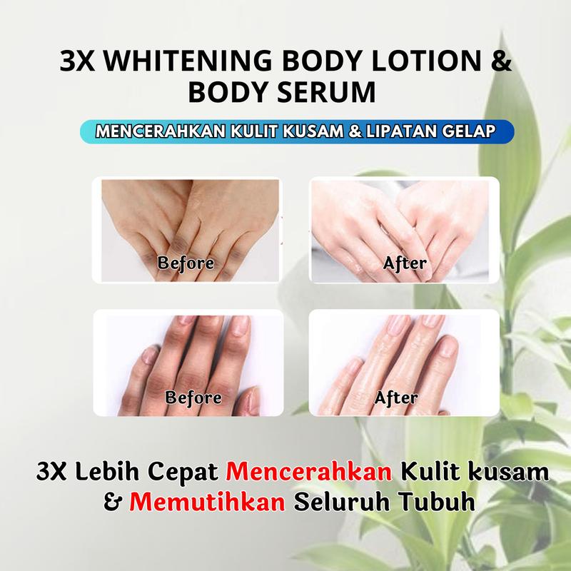 Cream Krim Pemutih Buku Jari Tangan Gelap, Cream Whitening Pemutih Jari Tangan Hitam, Pencerah Jari Tangan Gelap/ Kusam, Pelembab Kulit Kering, Penghilang Buku Tangan Gelap, Tangan Keriput, Kasar, Melembutkan & Menghaluskan Kulit [BPOM] 3