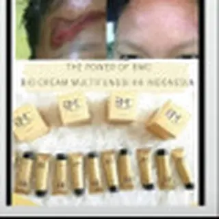 Krim Untuk Luka Bakar BMC (Bio Cream 30 gr) KK Indonesia Menggunakan Nano Techonolgy, Berbahan dasar Herbal, Membantu meringankan iritasi kulit, Melembabkan dan Mendinginkan Kulit, Menyembuhkan Hidung tersumbat/Flu, Keseleo, Ketombe dll 3
