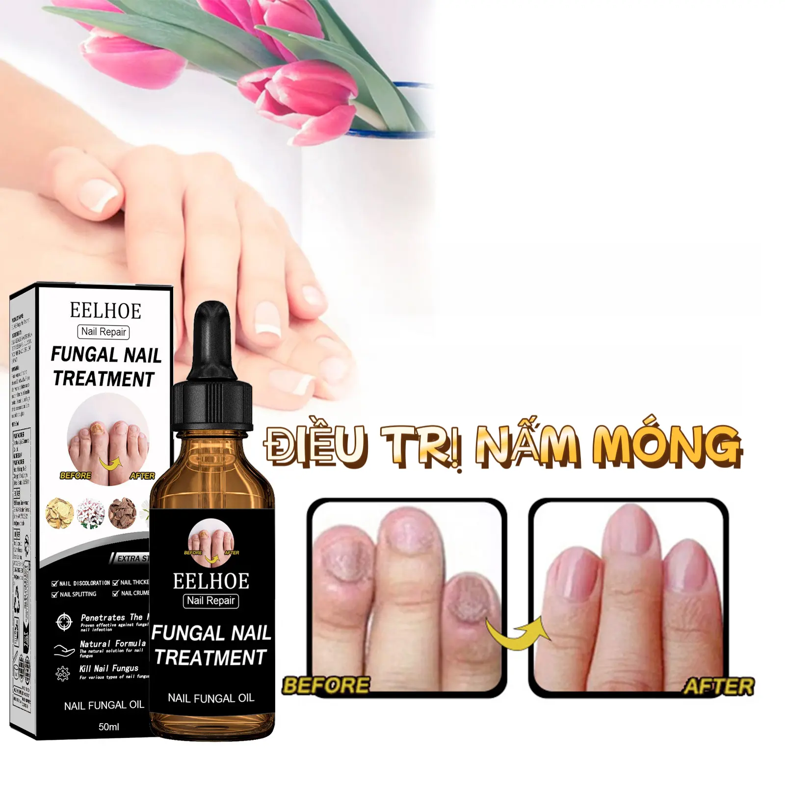 Dung Dịch Phục Hồi Móng EELHOE - Điều Trị Nấm Móng, Dưỡng Ẩm & Bảo Vệ