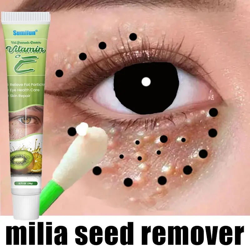 Milia Treatment Under Eyes Cream Milia Cream Milia Remover 20g Eye Fat Granules Small Under Eye Bulge