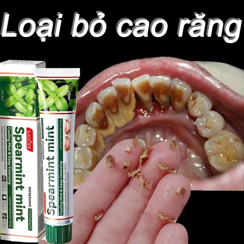 Kem đánh răng làm trắng răng loại bỏ cao răng hôi miệng tẩy ố vàng 100g làm trắng làm sạch răng làm mới hơi thở khử mùi chống sâu răng ức chế vi khuẩn phục hồi nướu hư tổn