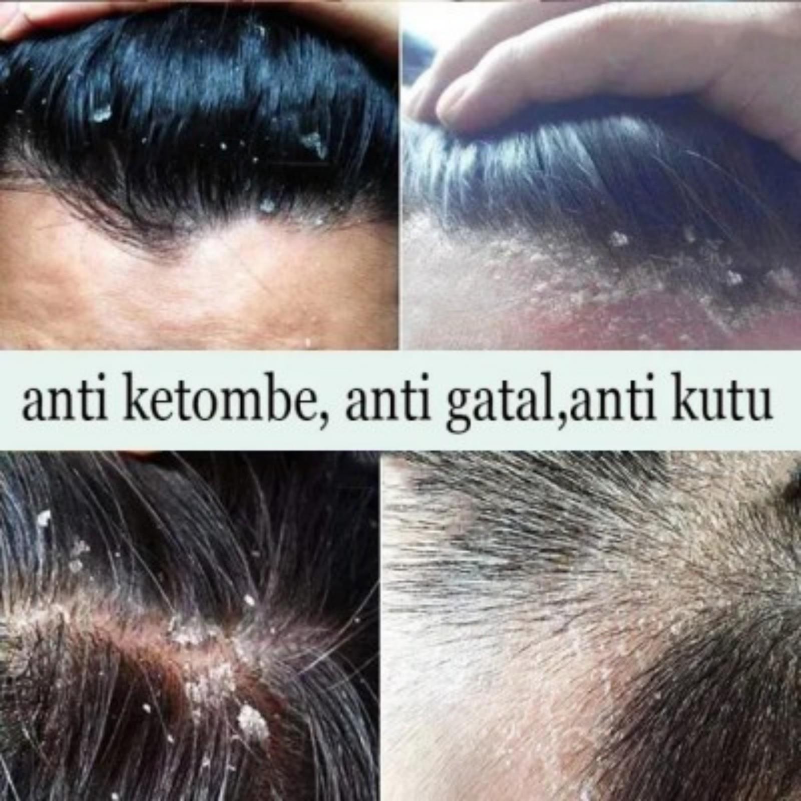 LIUFUSHA Shampo Anti Ketombe Penghilang Ketombe Anti Gatal Shampoo Sea Salt Shampoo Anti Rambut Rontok Dan Mengontrol Minyak Singkirkan ketombe Memperbaiki kulit kepala yang gatal Pembersihan mendalam dan kontrol minyak Rambut lebih halus 500ml LIUFUSHA Shampo Anti Ketombe Penghilang Ketombe Anti Gatal Shampoo Sea Salt Shampoo Anti Rambut Rontok Dan Mengontrol Minyak Singkirkan ketombe Memperbaiki kulit kepala yang gatal Pembersihan mendalam dan kontrol minyak Rambut lebih halus 500ml