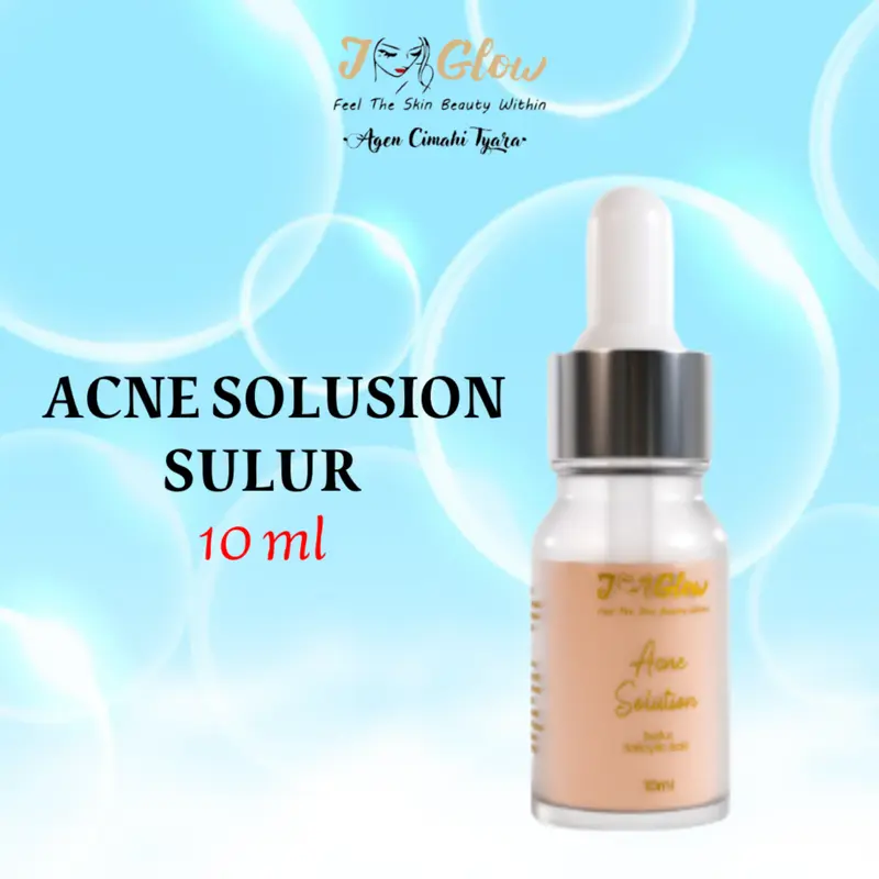 JGLOW TOTOL ACNE SALEP / TOTOL ACNE CAIR / TOTOL SALEP IRITASI Treatment Perawatan 0
