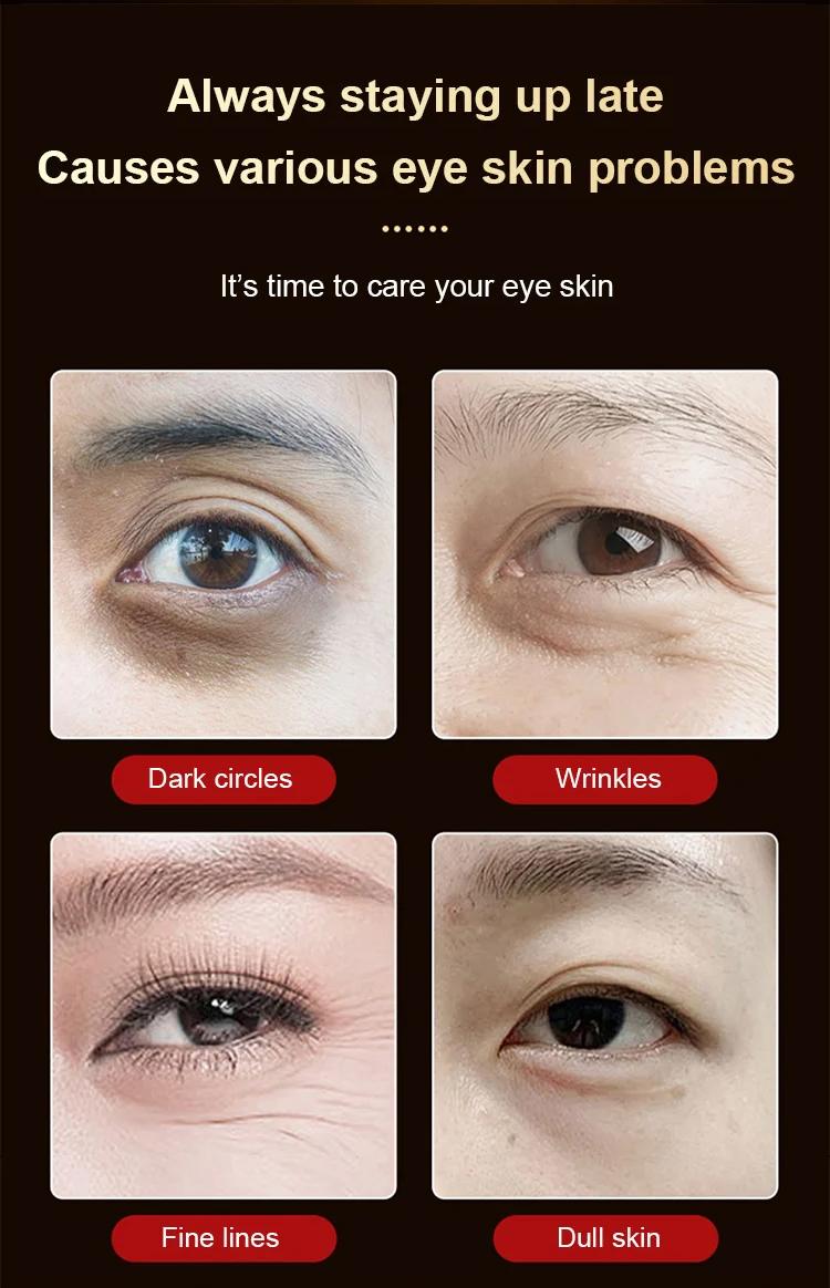 Dinkiss Eye Treatment Oil Improve Skin Radiance Reduce Wrinkles Relieve Puffiness