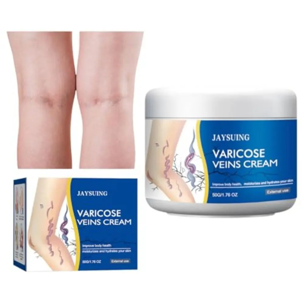 New 50g/1.76fl.oz Legs Varicose Veins Treatment Pain Relief Mild & Safe Varicose Veins Relief Cream Moisturizes The Skin Leg Phlebitis Cream for Men And Women