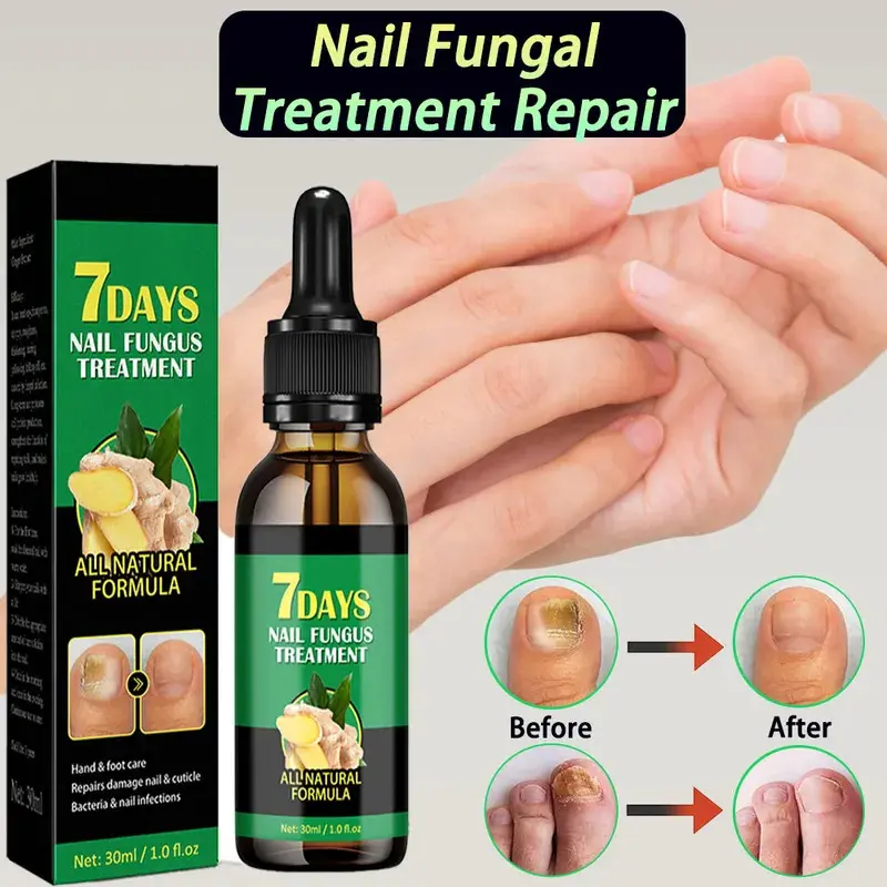 EELHOW Nail Repair Gel Strengthen Brighten Toenails Foot Nail Care Treatment Ginger Kutek 0