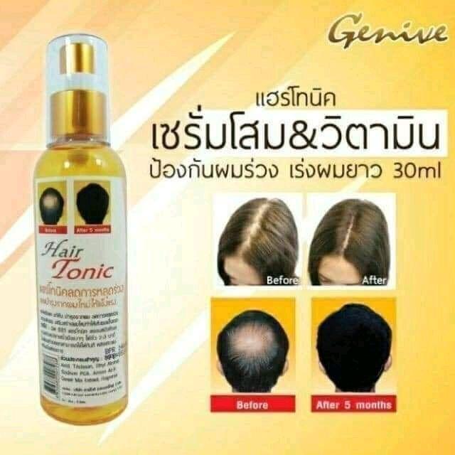 Genive Hair Tonic Thái Lan - Xịt Mọc Tóc Kích Thích & Ngăn Ngừa Rụng Tóc 30ml Dưỡng Tóc Dài Mạnh Khỏe Tự Nhiên 0