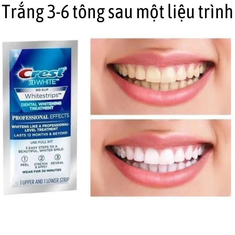 Miếng dán trắng răng Crest trắng nhanh không gây ê buốt phù hợp với mọi men răng [Giá 1 Gói] 1