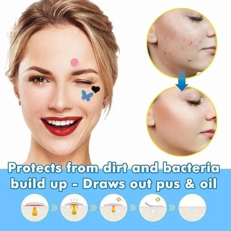 Acne patch lucu Pimple Patch Penghilang Jerawat Acnes Spot Care Plester Jerawat Acne Treatment 36 buah  stiker jerawat Cute Star/Heart Pimple Patch 8