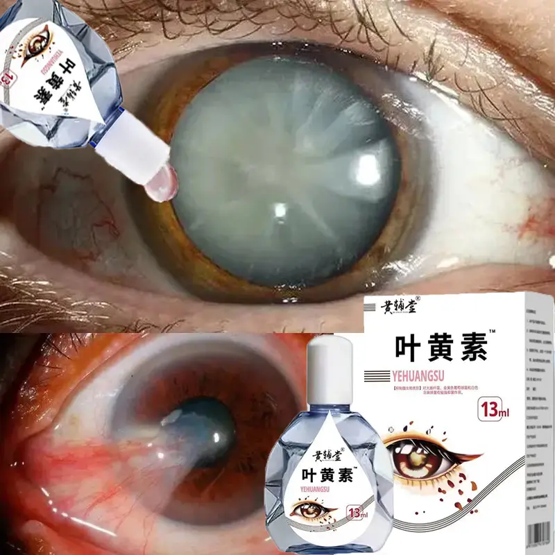 Eye Drops 13ML Eye Drops for Glaucoma Dry Eyes Eye Pain Redness Eye Pressure Ma Soft Eye Drops Itchy Eye Drops Oily Eye Drops Blurred Vision Natural Eye Drops