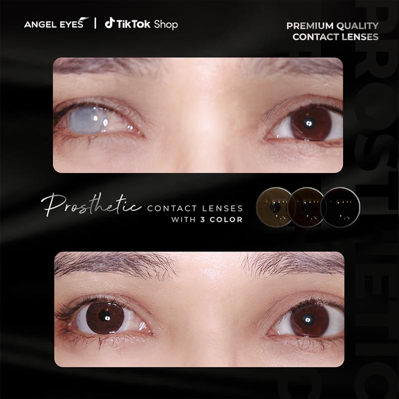Lens thẩm mỹ che khuyết điểm Angel Eyes kính áp tròng thẩm mỹ Dia 14.0 không giãn dành riêng cho mắt bị đục thủy tinh thế kéo mây cườm