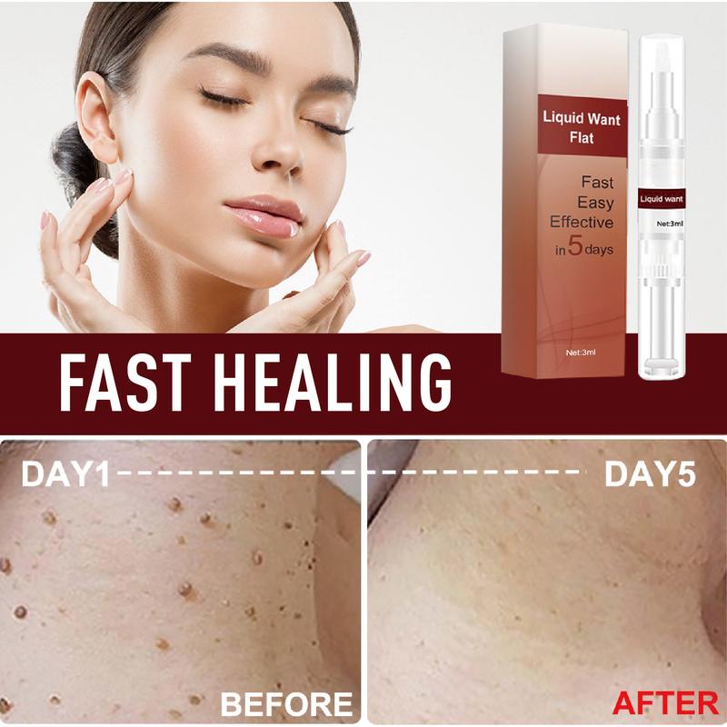Product Introduction of Warts Remover Cream Original Watson Warts Removal Mole Remover Organic Cream Skin Tags and Warts Remover Original 4