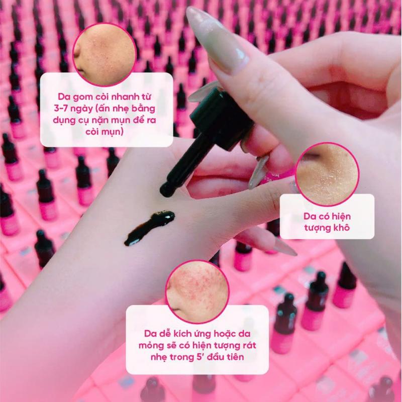 HM STORE SERUM GIẢM MỤN SERUM DIẾP CÁ HỖ TRỢ GIẢM MỤN, GIẢM THÂM 4