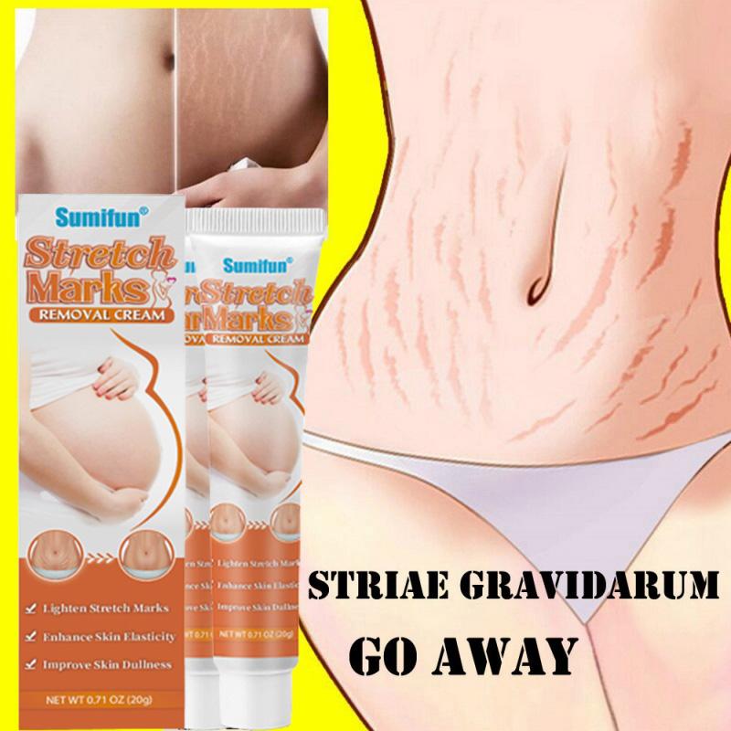 Kem Chống Rạn Da, Điều Trị Da Chuyên Sâu, Để Cải Thiện Và Loại Bỏ Sự Xuất Hiện Của Vết Rạn, Thích Hợp Để Loại Bỏ Vết Rạn Cắt, Hiệu Quả Để Loại Bỏ Đường Béo Và Vết Rạn Sau Sinh, Kem Phục Hồi Cơ Thể, Làm Sáng Da, Hiệu Quả Sau Khi Rạn Da 5