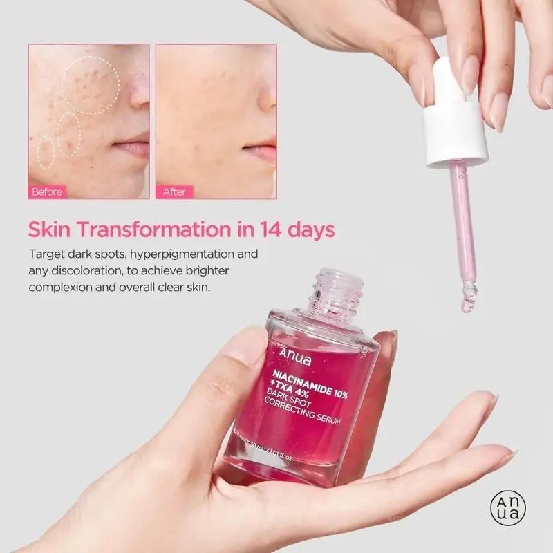 ANUA Niacinamide 10% + TXA 4% Dark Spot Correcting Serum 30ml Korea brightening serum Tranexamic Acid Serum XX251 Mild Secure 1