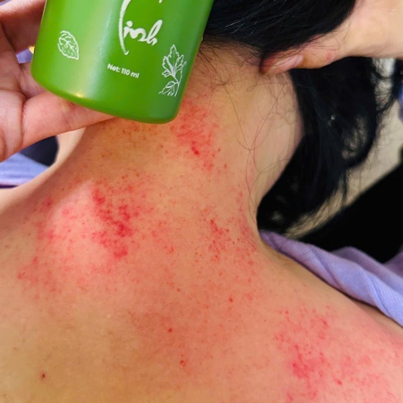 1 AN CỐT LINH- CON LĂN MASSAGE CỔ , VAI GÁY, TAY CHÂN, XƯƠNG KHỚP 7