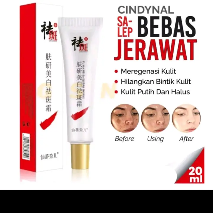 Cindynal krim flek hitam pemutih Kulit Kering Kulit sensitif Kontrol Minyak Semua Jenis Kulit Wajah Perawatan Muka Mencerahkan