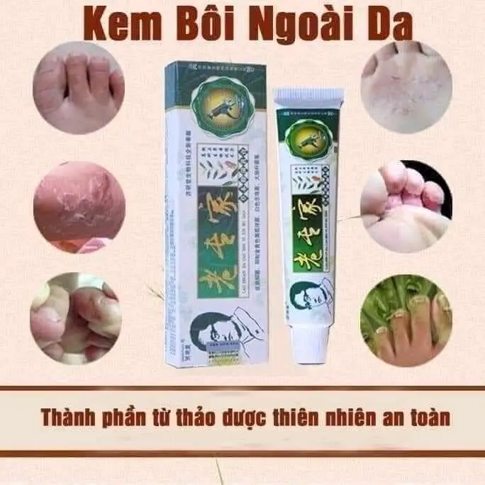Kem bôi ngoài da thảo mộc OTC 15g