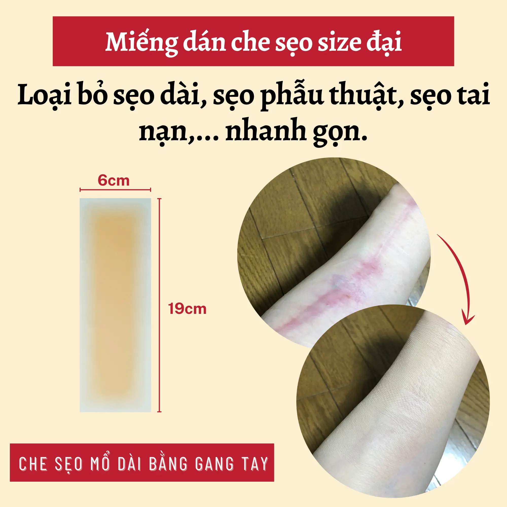 Miếng dán che sẹo dài, sẹo phẫu thuật, che khuyết điểm siêu mỏng chống nước, chống mồ hôi