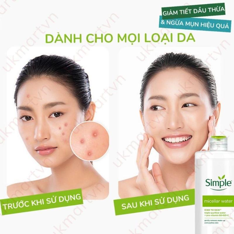 Product Introduction of Nước tẩy trang Simple Kind To Kind Micellar Cleansing Water cho da nhạy cảm - Tẩy trang Simple 69