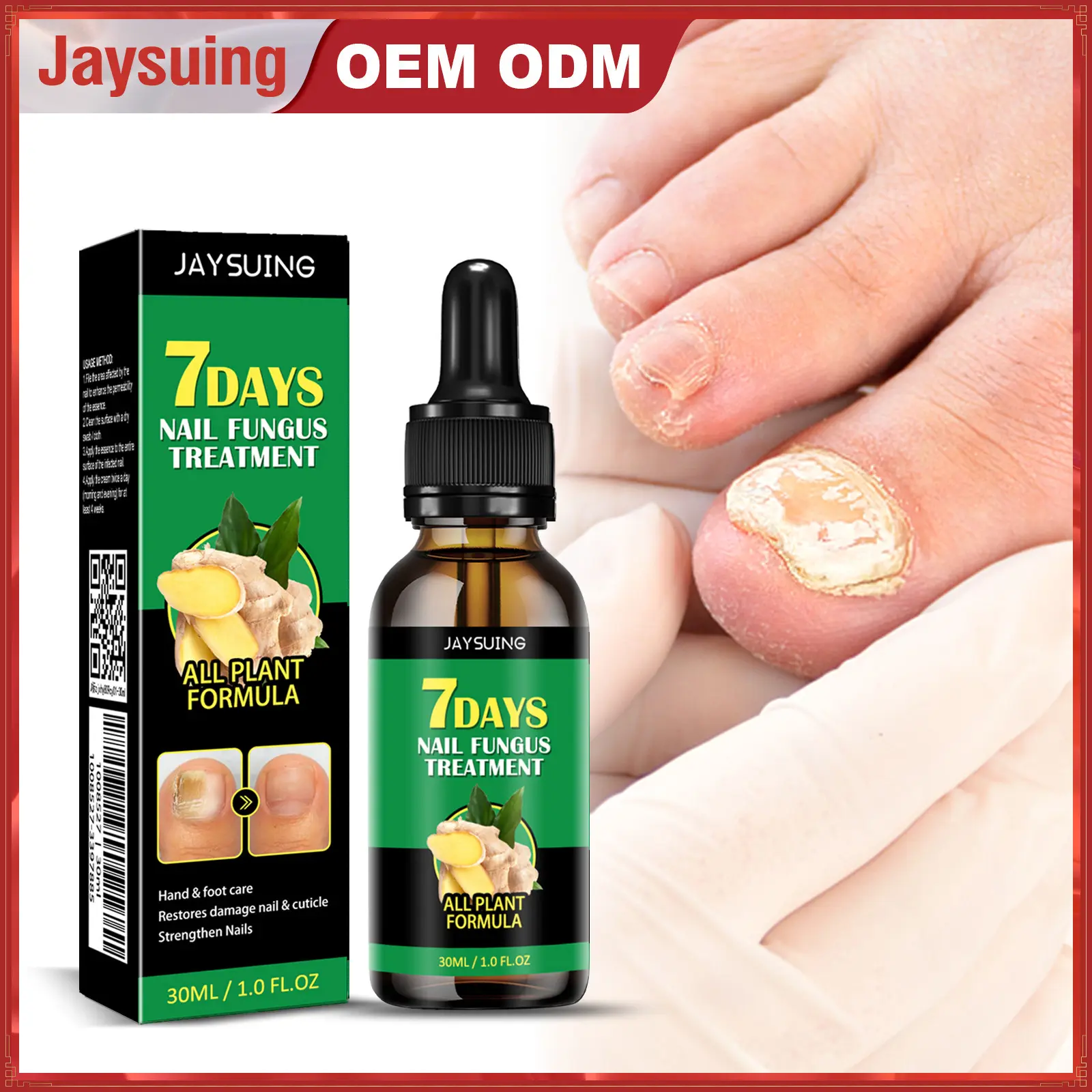 Jaysuing Ginger Nail Care Solution for Nail Fungus Repair