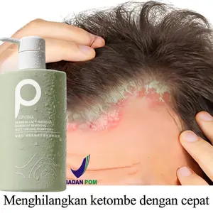 LIUFUSHA Shampo Anti Ketombe Penghilang Ketombe Anti Gatal Shampoo Sea Salt Shampoo Anti Rambut Rontok Dan Mengontrol Minyak Singkirkan ketombe Memperbaiki kulit kepala yang gatal Pembersihan mendalam dan kontrol minyak Rambut lebih halus 500ml