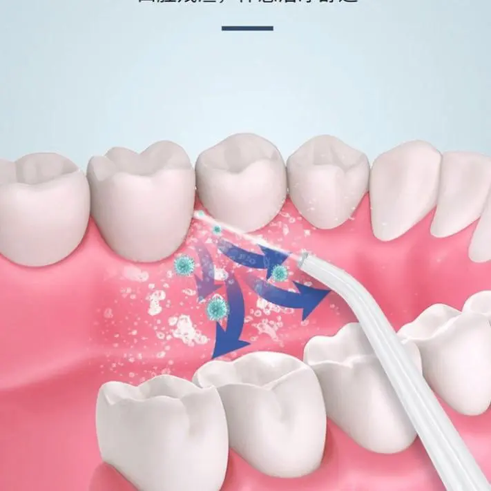Máy tăm nước vệ sinh răng miệng cực sạch công nghệ Châu Âu - Máy Tăm nước siêu sạch Oral Irrigator kèm 4 đầu phun Nữ Women 5