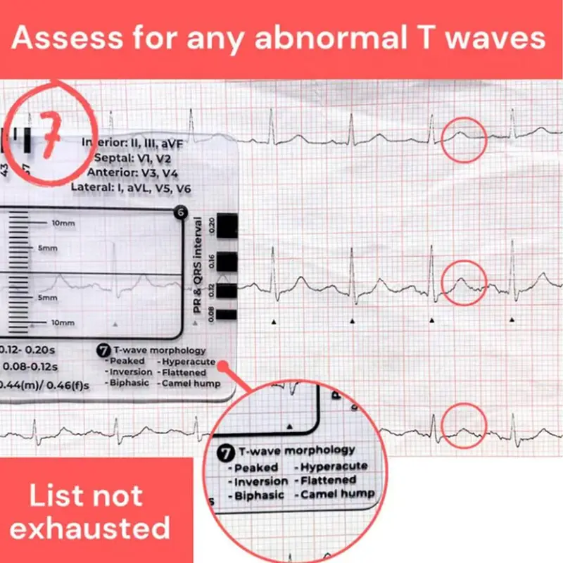Thước 7 Bước, Cầm Tay, Hướng Dẫn Tham Khảo Bỏ Túi Giải Thích Ecg, Trong Suốt, Thiết Kế Nhỏ Gọn, Dụng Cụ Đánh Giá, Để Đo Lường 7