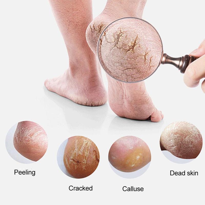 Product Introduction of 2PCS Gel Heel Socks Moisturing Spa Gel Socks Feet Care Cracked Foot Dry Hard Skin Protector Prevent Dry Heel Feet Care Tools 30