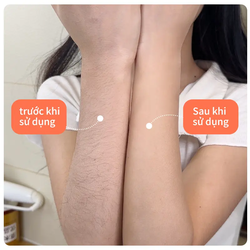Domon dolly dao cạo lông cho phụ nữ - Xóa bỏ lông nách, chân, tay mà không để lại vết thâm, tích hợp thanh dưỡng ẩm 5