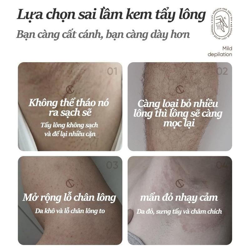Kem tẩy lông SADOER , tẩy lông vùng kín, nách, tay, chân, triệt lông an toàn không đau rát dung tích 150ml ZYC11CSD1C 2