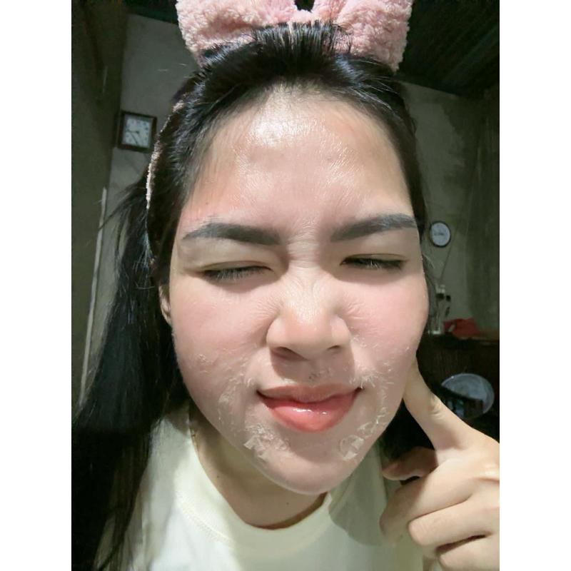 PEEL DA MẶT VI TẢO CAO CẤP - tẩy da chết - giảm mụn thâm mờ nám tàn nhang - thay da sinh học peel lột da mặt retinol 3