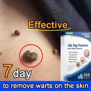 144PCS/Box Penghilang Tahi Lalat Stiker - Cepat Menghilangkan Tahi Lalat Di Wajah, Obat Kutil Paling Efektif, Skin Tag dan Wart - Remover Patch