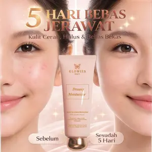 Glowies Beauty Dreamy Moisturizer 80ml Aman untuk Remaja & Kulit Sensitif with 7% Azelclair Niacinimide Alpha Arbutin 5x Ceramide Bantu Redakan Jerawat & PIE Memperbaiki Skin Barrier dan Acne Repair Non Comedogenic