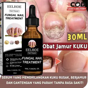 Nail Repair Essence Serum Original Serum Kuku | Perawatan Kuku Berjamur | Serum Penghilang Jamur Di Kuku | Vitamin Kuku Rusak | Memperbaiki Kuku Rusak