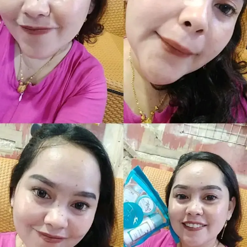 Serum AF Gold Mengencangkan Wajah Kerutan 7