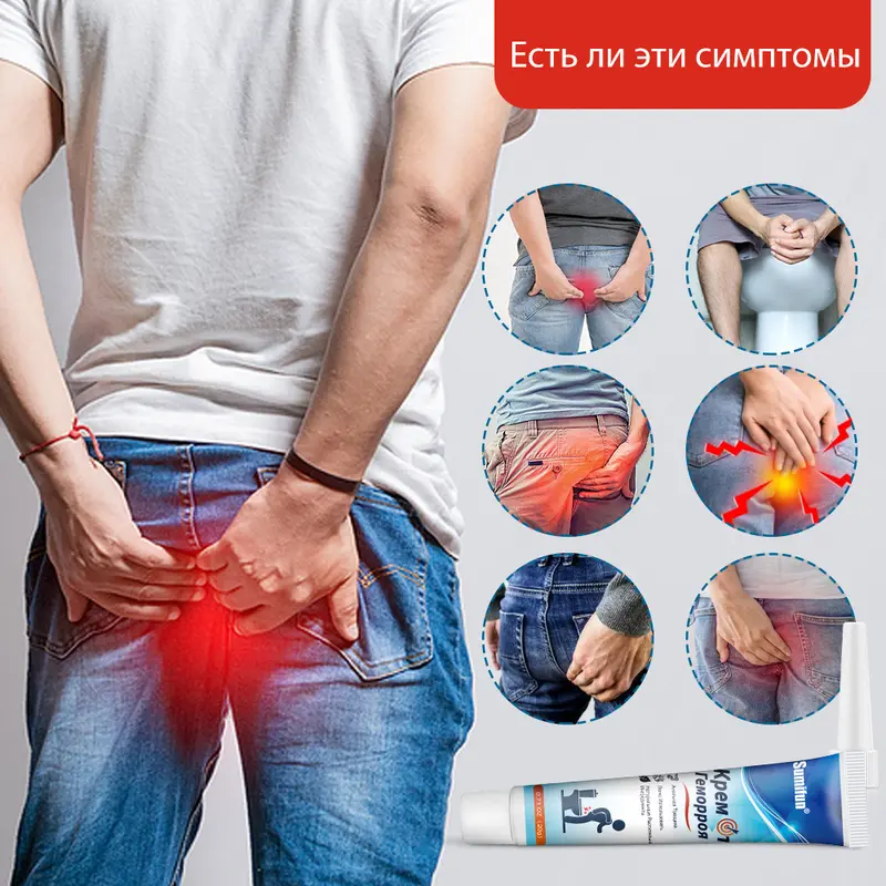 Kem trĩ tự nhiên, kem trĩ giảm đau và ngứa, kem trĩ dành cho người lớn ít vận động, phù hợp cho cả nam và nữ，20g kem  ketoconazole 4