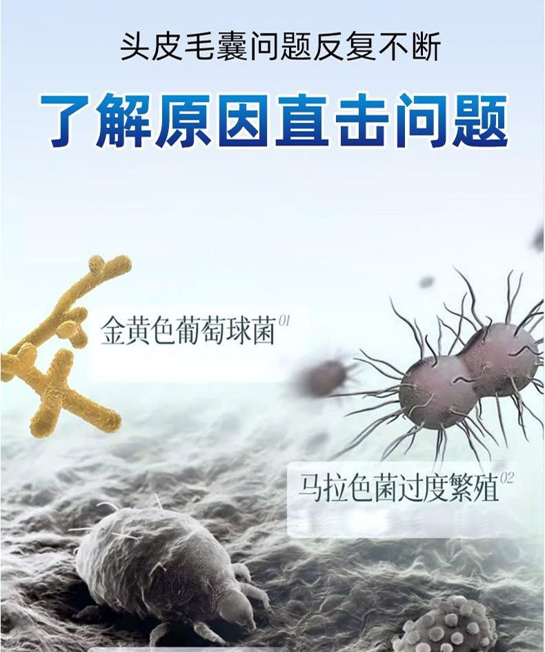 Product Introduction of Xikangwang Anti-Dandruf and Relieve Itching Washing Water Oil Removing Refreshing Skin Washing Cream Anti-Mite Grease-Overflow Moss Lotion 5