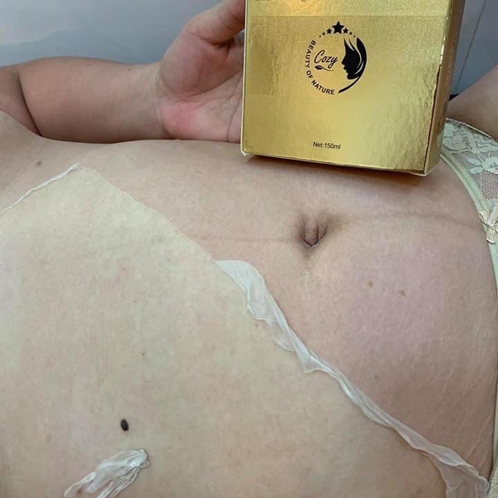 lột da body tay cổ cao cấp 30p kèm dưỡng ẩm , kích bong lần 2 7