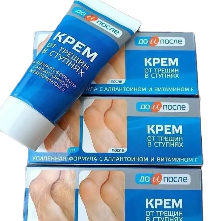 Kem bôi dưỡng ẩm gót chân Kpem của Nga