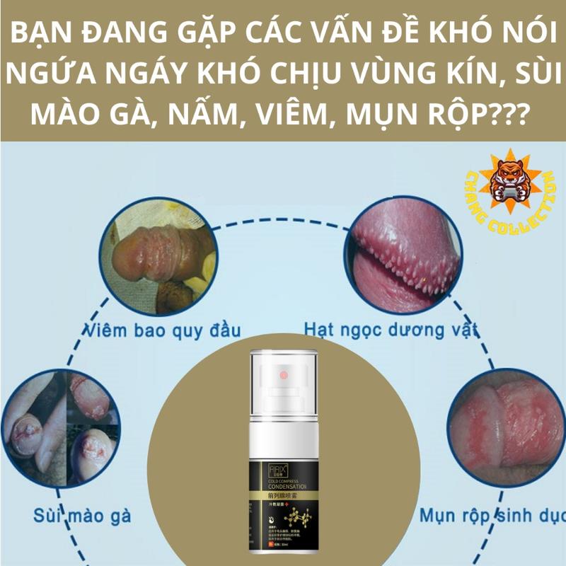 HOÀN TIỀN 15% - Xịt mát hết khó chịu vùng kín vảy trắng mùi hôi sùi mào gà mụn rộp sinh dục viêm nấm u nhú 3