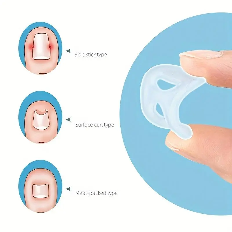 Soft Silicone Nail Groove Corrector, 2 Counts Comfortable Nail Corrector Suitable for All, Manicure & Pedicure Tools for Home & Salon Use 3