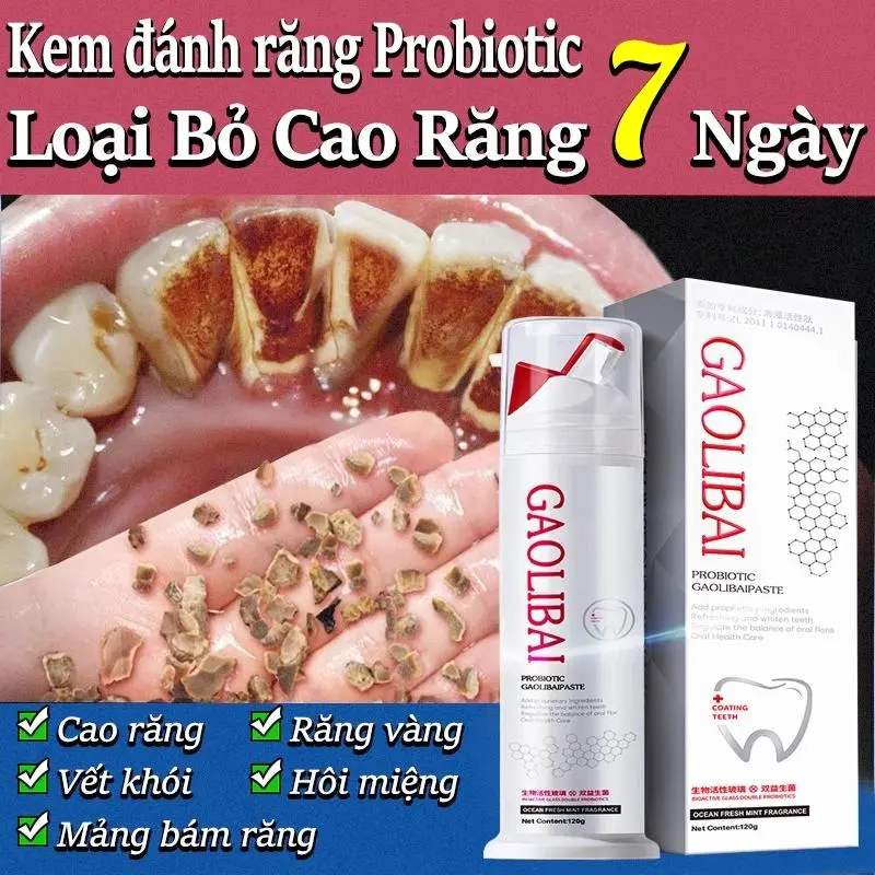 Kem Đánh Răng 120g - Làm Trắng Răng Đánh Bật Cao Răng, Sạch Mảng Bám, Hơi Thở Thơm Mát, Kem Đánh Răng Trắng, Tẩy Trắng