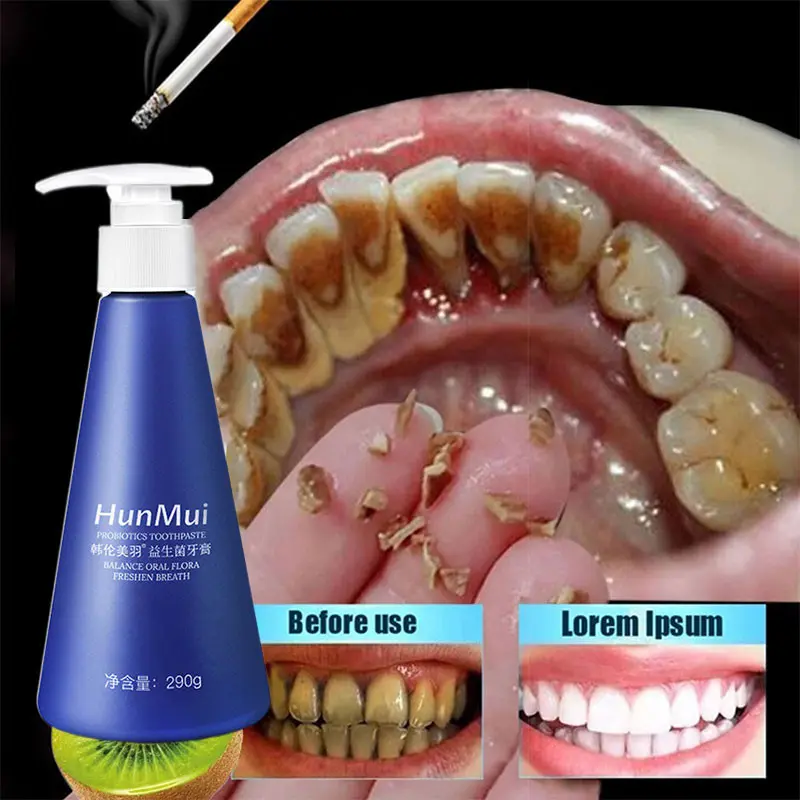 Toothpaste Whitening Toothpaste Removes Tea Ttains Tobacco Ttains Coffee Stains And Dental Calculus Prevent Tooth Decay