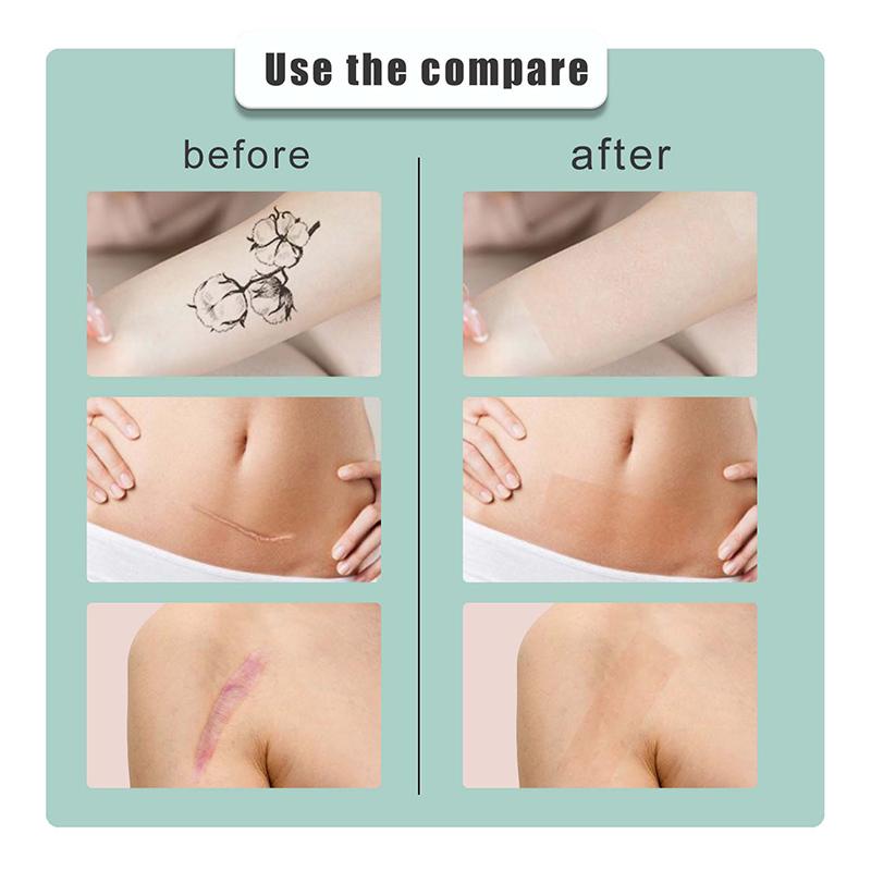 1 Cuộn Kem Che Khuyết Điểm Tông Màu Da, Miếng Dán Hình Xăm, Che Hình Xăm, Vết Sẹo Bỏng, Vết bớt, Miếng Dán Vô Hình, Băng Dính Không Thấm Nước Trang Điểm Xăm Môi 4