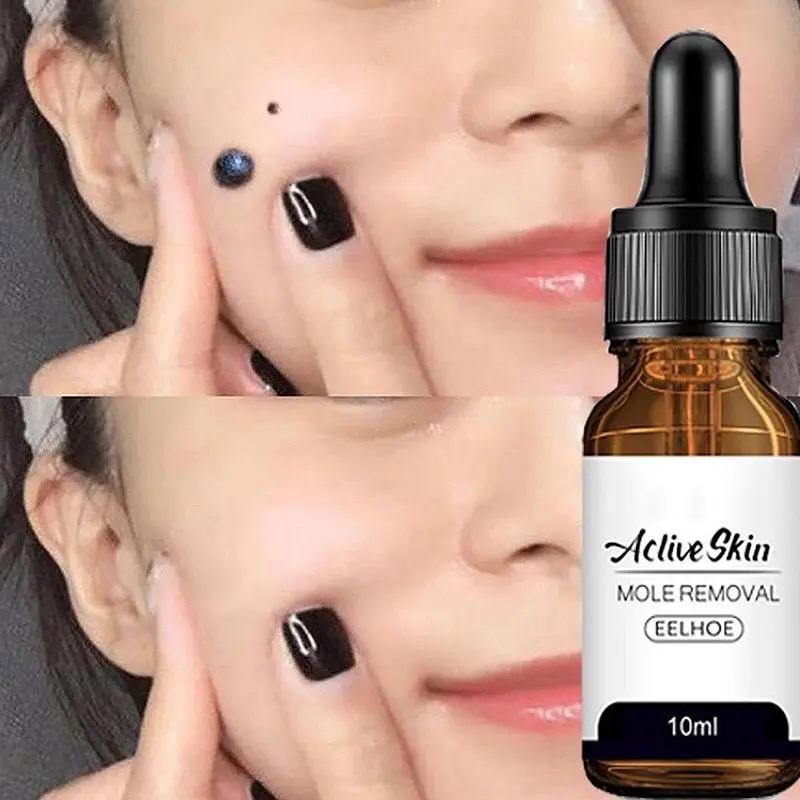 Eelhoe Aclive Skin Mole Removal, Serum Penghilang Tahi Lalat Dan Kutil Isi 10ml Perawatan Essence Cairan 1