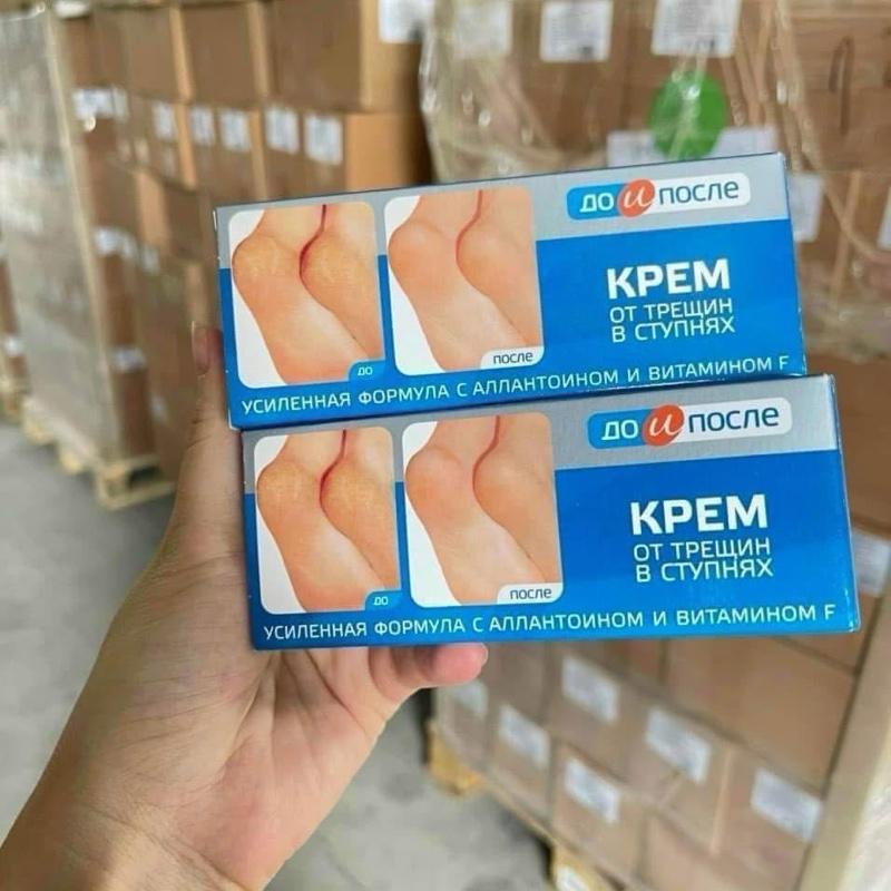 Kem bôi nứt , nẻ gót chân kpem hàng nga 50ml 1