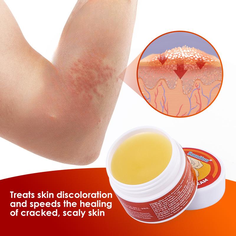 Kem Trị Viêm Da, 10g, Kháng Khuẩn, Chống Ngứa, Vết Bỏng, Kem Chăm Sóc Da 3